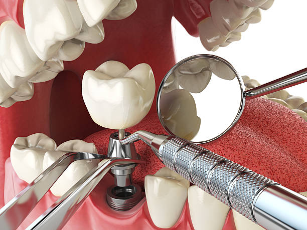 Best Emergency Cosmetic Dentistry (e.g., broken veneers) in Baltic, SD